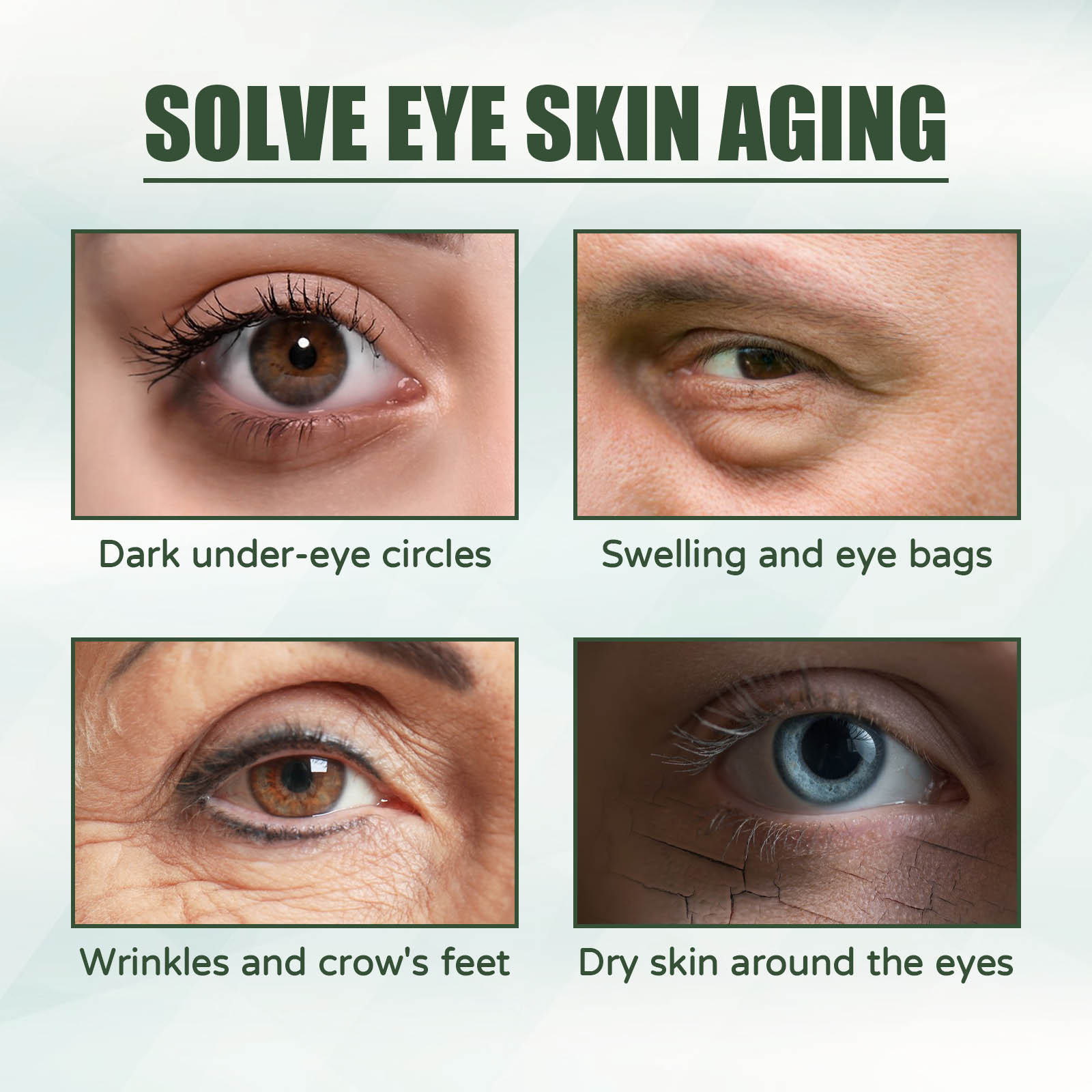 EELHOE-Anti-Aging Eye Cream, R - Women Bags Under Eyes avaliação e preço